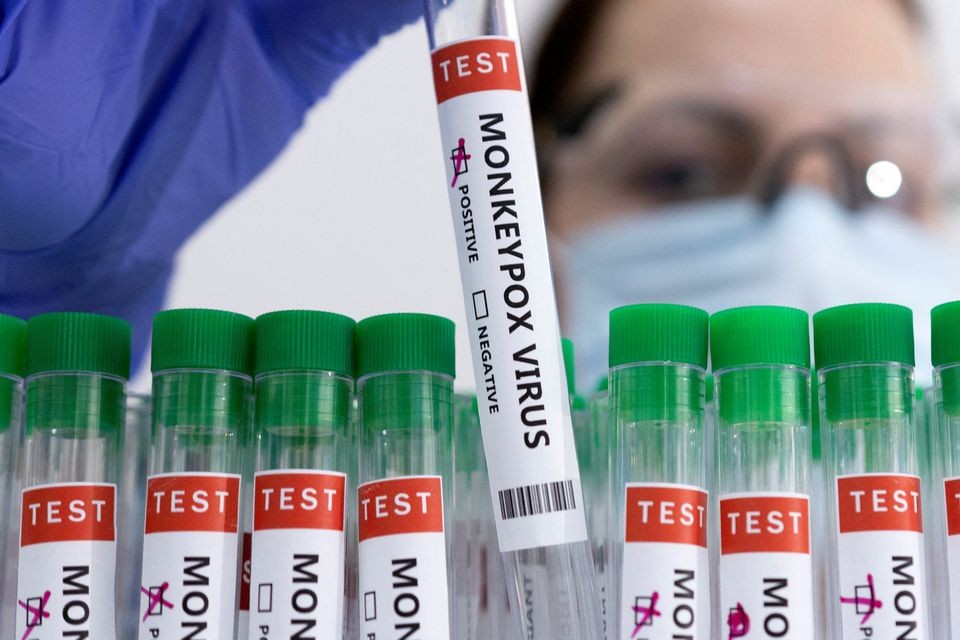 EU cấp phép sử dụng vaccine Imvanex trong phòng chống bệnh đậu mùa khỉ