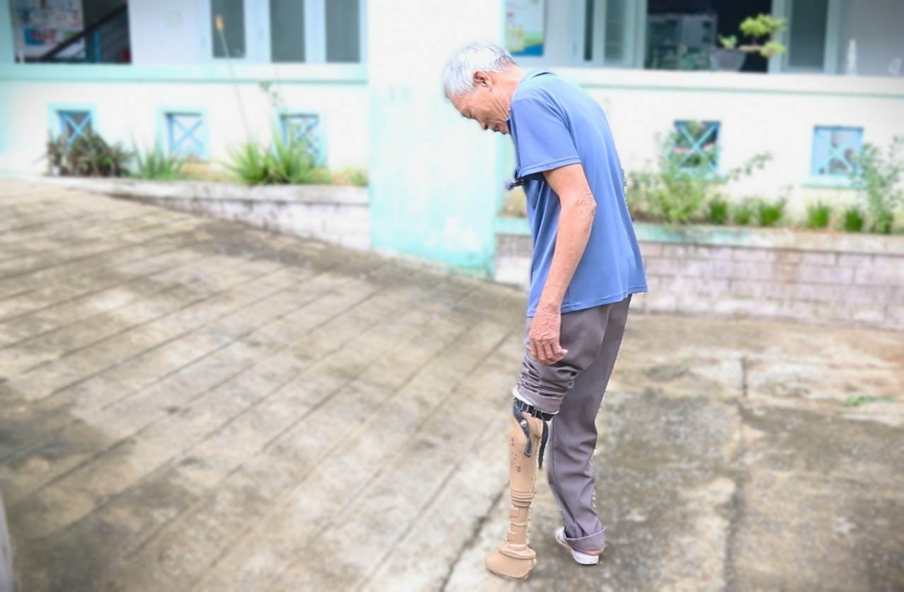 MCNV hỗ trợ làm chân tay giả, giày nẹp chỉnh hình cho người khuyết tật