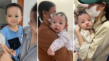 Operation Smile hỗ trợ phẫu thuật nụ cười cho trẻ em Thừa Thiên Huế