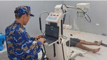 benh xa dao sinh ton cap cuu ngu dan bi vo xuong
