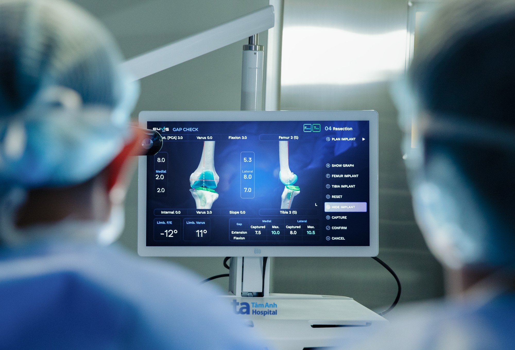 Việt Nam lần đầu có Robot AI thay khớp “siêu thao tác” chuẩn xác Việt Nam lần đầu có Robot AI thay khớp “siêu thao tác” chuẩn xác