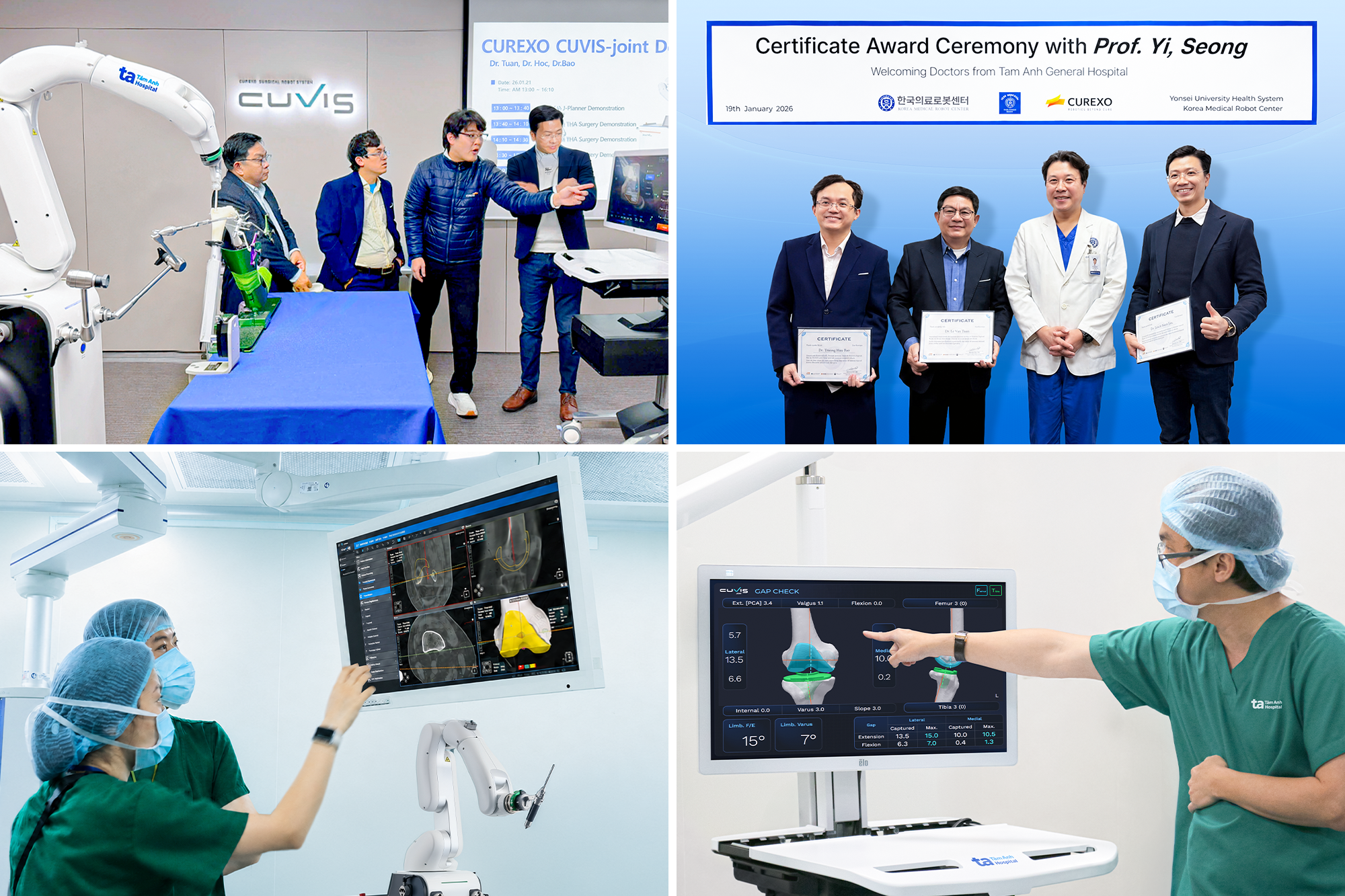 Top đầu thế giới, Bệnh viện Việt Nam vượt mốc 100 ca thay khớp khó nhờ “siêu robot” AI Top đầu thế giới, Bệnh viện Việt Nam vượt mốc 100 ca thay khớp khó nhờ “siêu robot” AI