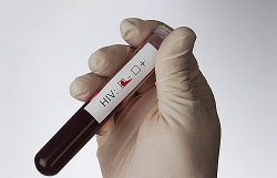 Cấy ghép tế bào gốc - phương pháp cứu người bệnh khỏi virus HIV