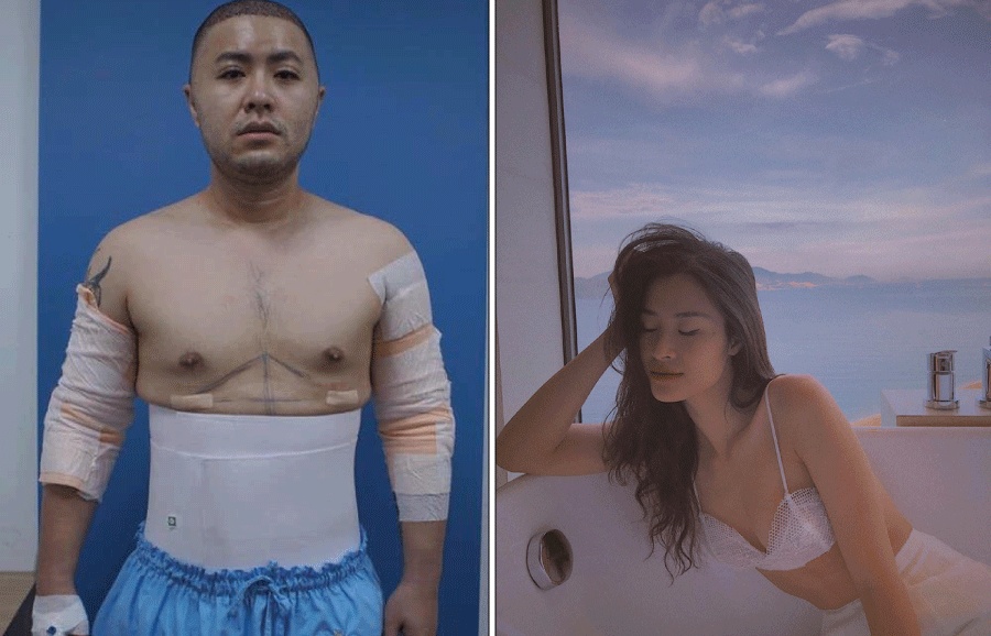 facebook sao viet hom nay 156 akira phan phau thuat tham my sau khi bi che dong nhi khoe sac quyen ru