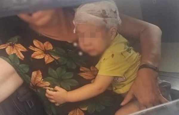 Bị chổi lau nhà rơi từ tầng 17 trúng đầu, bé trai 16 tháng tuổi nhập viện khẩn cấp