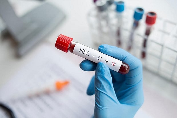 hờ phương pháp cấy ghép mới, một bệnh nhân nữ đầu tiên trên thế giới đã được chữa khỏi bệnh HIV. (Nguồn: Getty Images)