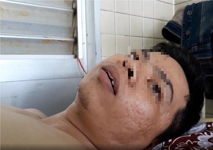 vu benh nhan bi gay xuong nguc nhung khoan nham cang chan benh vien cho ray noi gi