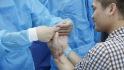 Việt Nam thực hiện ca phẫu thuật ghép bàn tay từ người sống