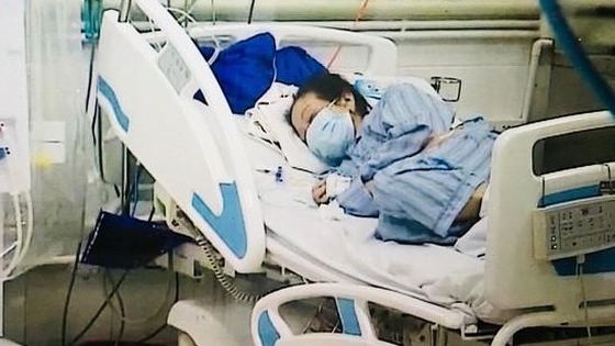 covid 19 bac gai benh nhan 17 tro nang 3 lan ngung tuan hoan