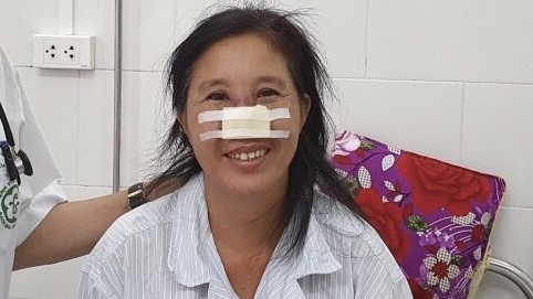 Bệnh nhân bị vi khuẩn whitmore “ăn” cánh mũi đã xuất viện