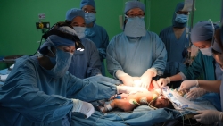 Cận cảnh ca phẫu thuật tách rời cặp sinh đôi dính liền bụng hơn 1 tháng tuổi