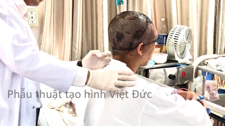 ha noi nguoi phu nu bi lot toan bo da dau vi toc quan vao may