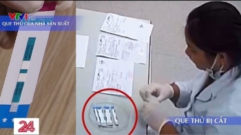 benh vien xanh pon cat doi test hiv viem gan b cong an ha noi vao cuoc