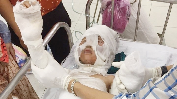 tin phap luat 24h nong nhat hom nay 242 bi di tuoi xang dot chau trai bong nang