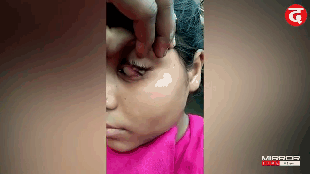 Video: Kỳ lạ thiếu nữ 15 tuổi khóc ra "đá" suốt 2 tháng