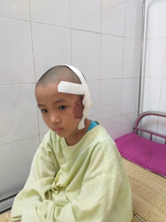 Quảng Bình: Thảm cảnh cả nhà cùng nằm viện sau tai nạn giao thông