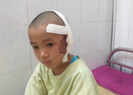 quang binh noi dau cua nguoi dan ong nuoi bo chay than vo con gap tai nan giao thong
