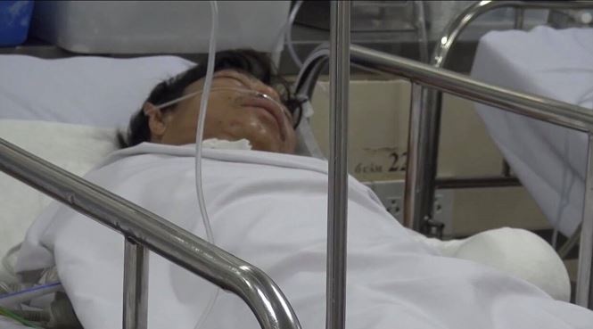 loi ke rung minh cua nan nhan bi ho can dut 2 tay o binh duong