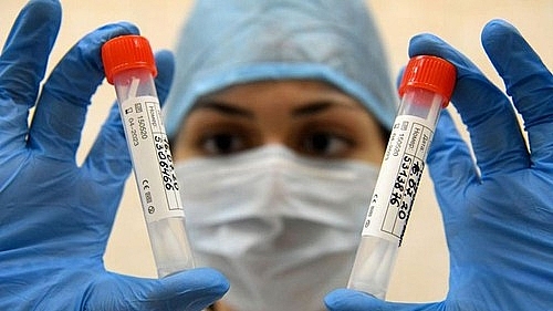 Nga sản xuất vaccine ngừa COVID-19 đầu tiên 'hoàn toàn mang tính nhân văn'