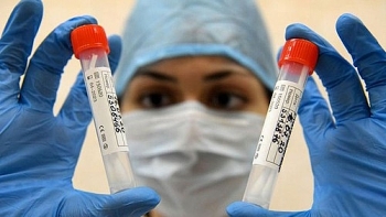 nga san xuat vaccine ngua covid 19 dau tien hoan toan mang tinh nhan van