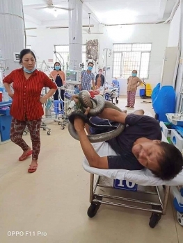 tay ninh bi ran ho mang can nguoi dan ong mang luon thu pham vao benh vien de dieu tri