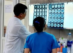 Xuất hiện ca xuất huyết não đầu tiên ở Việt Nam do ngộ độc ma tuý đá