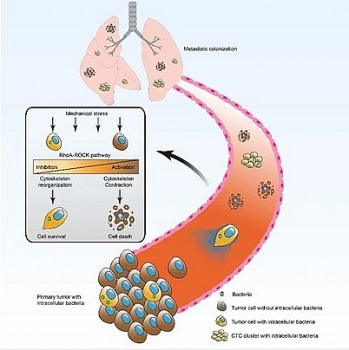 vi khuan tac nhan khien te bao ung thu di can