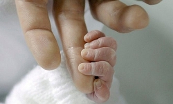Hy hữu em bé được sinh ra từ người mẹ đã chết não 3 tháng