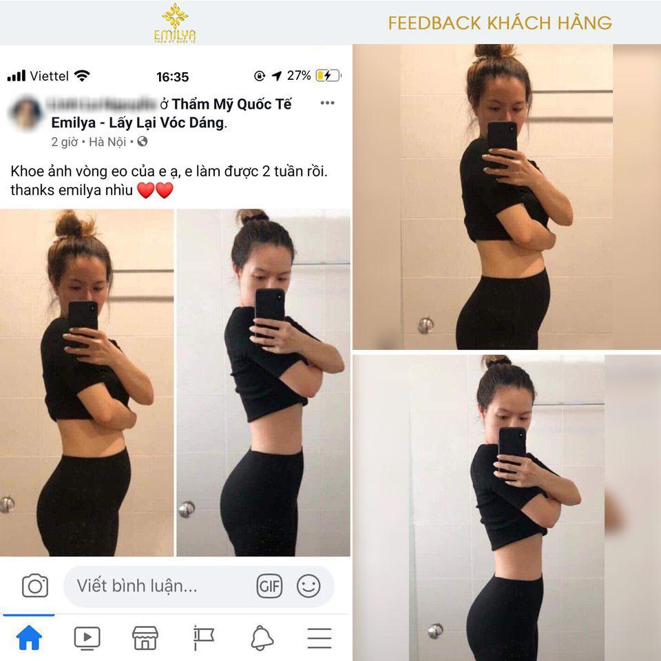 Thẩm mỹ viện Emilya có tốt không?