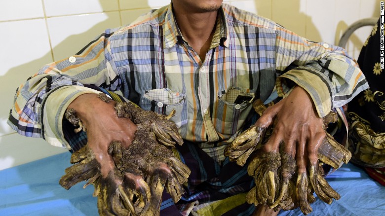 nguoi cay abul bajandar ky vong vao cuoc song moi