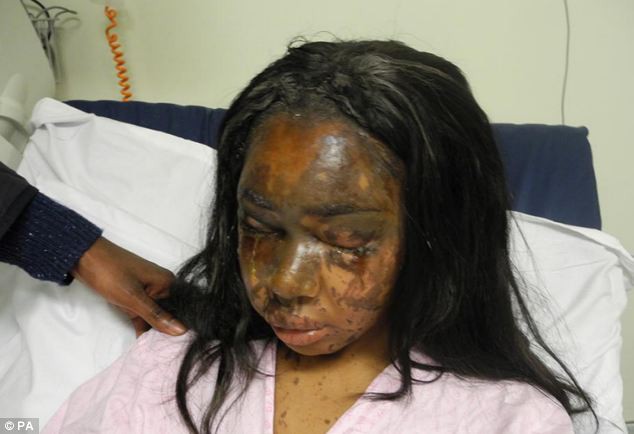 ghen ti vi ban than dep hon minh co gai nhan tam dung axit huy hoai dung nhan ban de tra thu