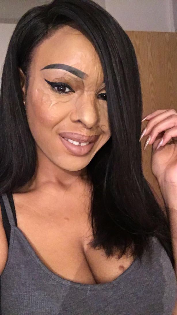 ghen ti vi ban than dep hon minh co gai nhan tam dung axit huy hoai dung nhan ban de tra thu