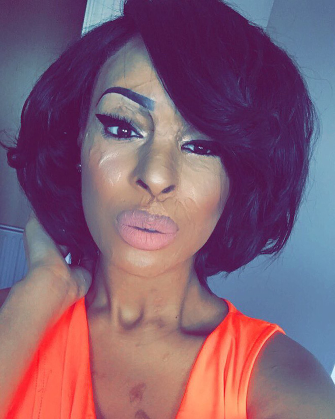 ghen ti vi ban than dep hon minh co gai nhan tam dung axit huy hoai dung nhan ban de tra thu