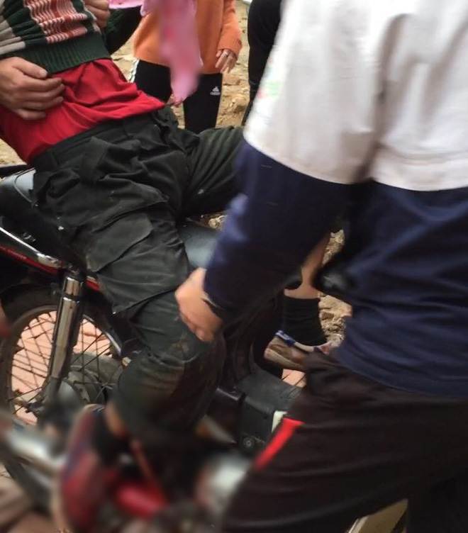 nguoi dan ong bi no nat ban tay khi nhat vo dan sau vu no kinh hoang o bac ninh