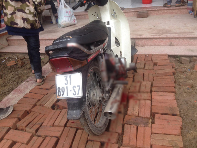 nguoi dan ong bi no nat ban tay khi nhat vo dan sau vu no kinh hoang o bac ninh