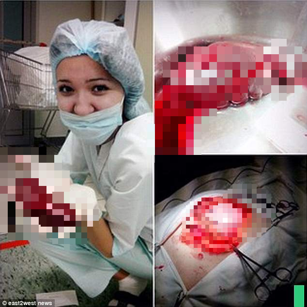 benh nhan dang chien dau gianh lai su song y ta vo tu chup anh va binh luan khiem nha