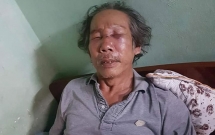 bao ve chung cu sai gon danh ong gia 68 tuoi rach mat gay song mui vi dau xe sai quy dinh