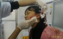 thanh hoa nu sinh lop 11 bi danh rach mat 14cm phai nhap vien cap cuu anh trai cau cuu cong dong mang