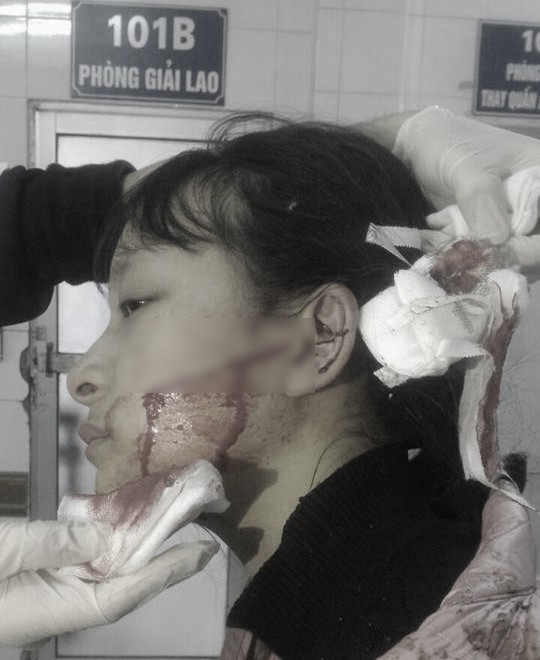 thanh hoa nu sinh bi hang xom dam rach mat vi nghi an cap mau quan ao ve ban