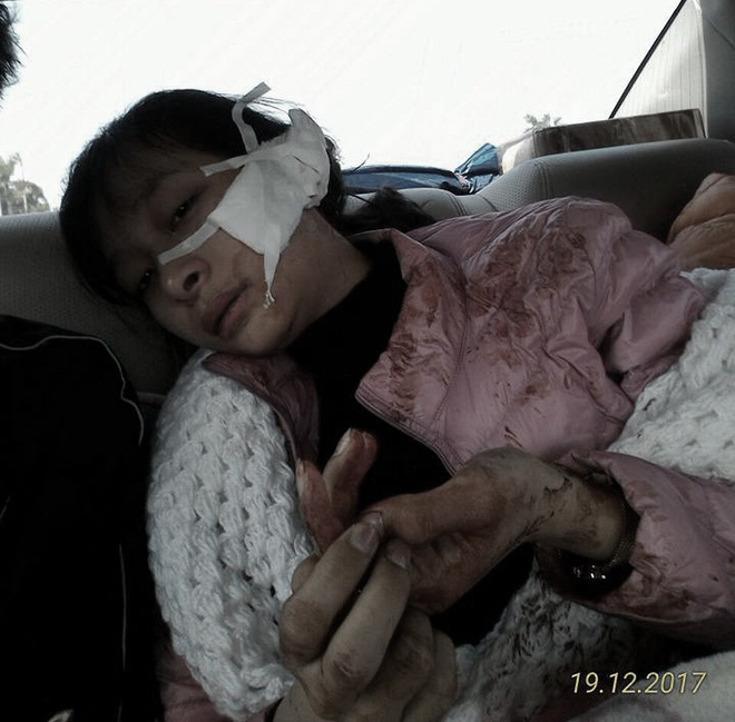 thanh hoa nu sinh bi hang xom dam rach mat vi nghi an cap mau quan ao ve ban