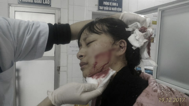 thanh hoa nu sinh bi hang xom dam rach mat vi nghi an cap mau quan ao ve ban