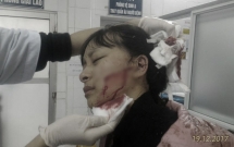 thanh hoa nu sinh bi hang xom dam rach mat vi nghi an cap mau quan ao ve ban