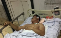 ha noi truy tim nhom nguoi trom cay canh di xe o to tai keo le chu nha 25m roi bo chay