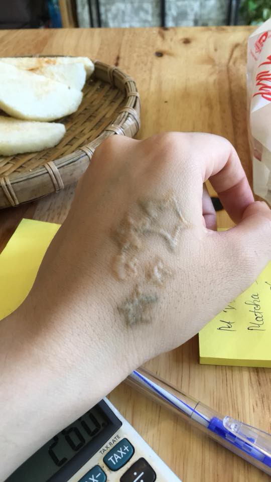 dan mang chia se chuyen di xoa xam dau mot lan roi thoi nhung de lai vet seo xau xi ca doi