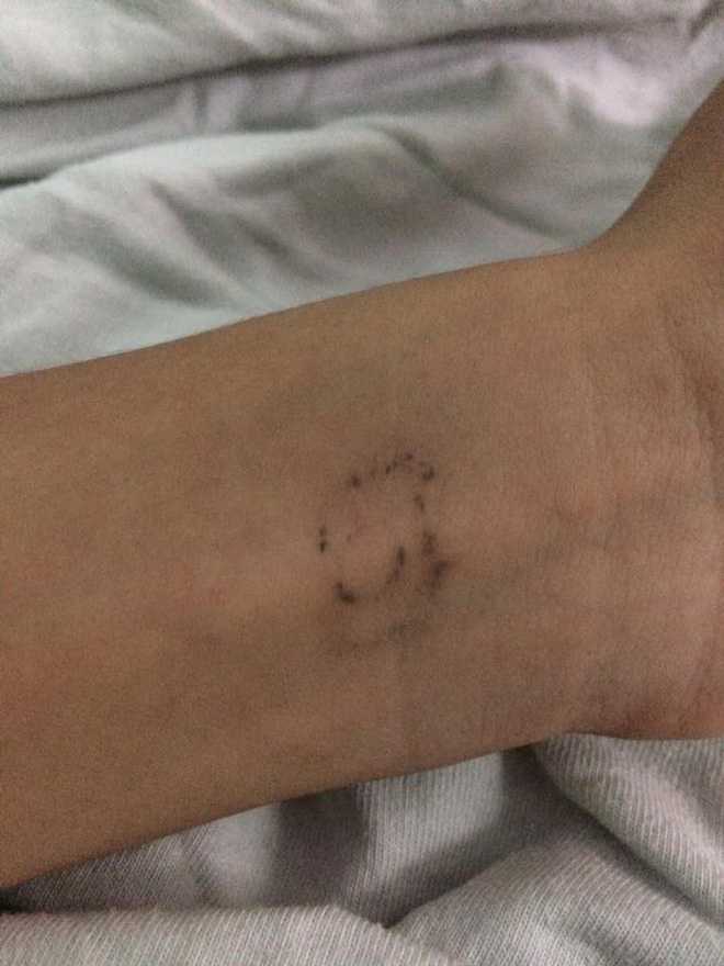 dan mang chia se chuyen di xoa xam dau mot lan roi thoi nhung de lai vet seo xau xi ca doi