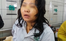 mot phu nu nguy kich xo gan nghi do su dung thuc pham chuc nang de giam can