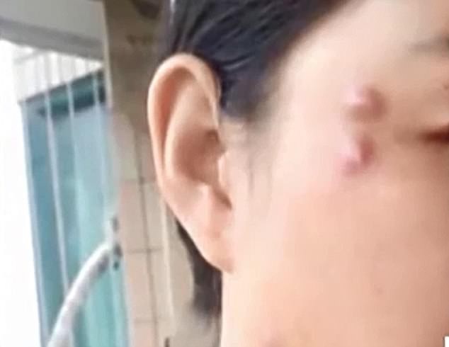 vai cuc u chay quanh mat nguoi phu nu nguyen nhan du khien nhieu nguoi phai suy nghi