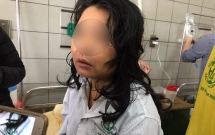 bac si len tieng vu nu benh nhan nguy kich nghi do dung tpcn de giam can