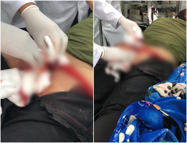 vu thanh nien 17 tuoi bi cua rach mong khi di ve sinh nan nhan nang den 100kg nen bon cau bi be