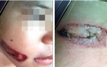 vu be gai nghi bi gi sat nung vao nguoi giat minh truoc cau tra loi cua chinh quyen